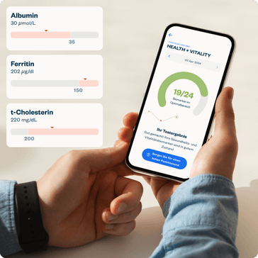 Ergebnisbericht erhalten